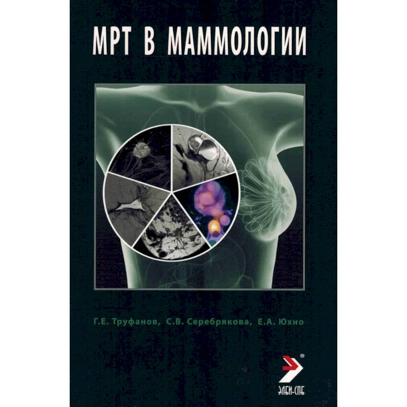 МРТ в маммологии: руководство для врачей