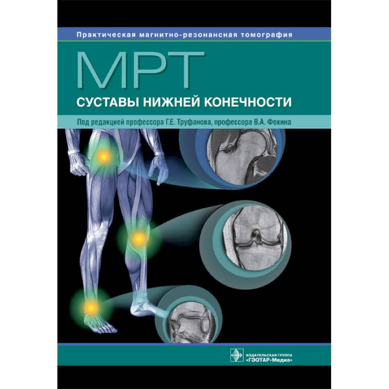 МРТ. Суставы нижней конечности