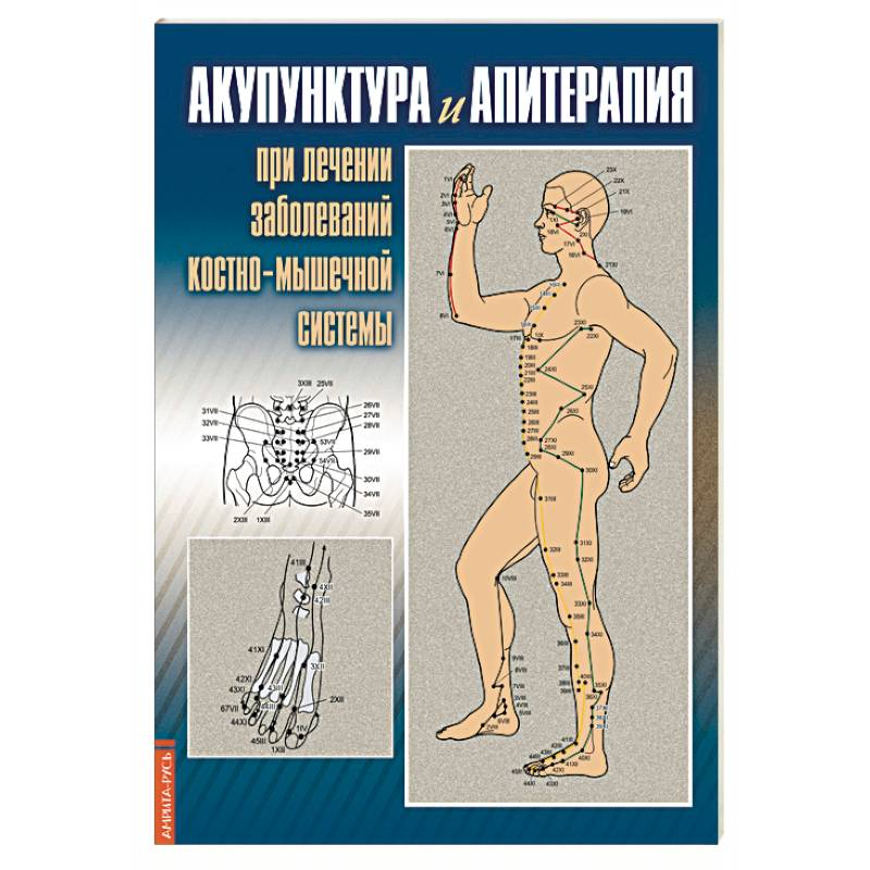Акупунктура и апитерапия при лечении заболеваний костно-мышечной системы