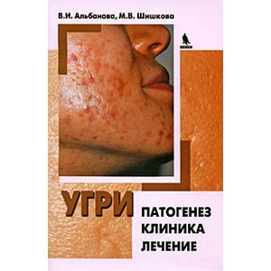 Угри. Патогенез. Клиника. Лечение