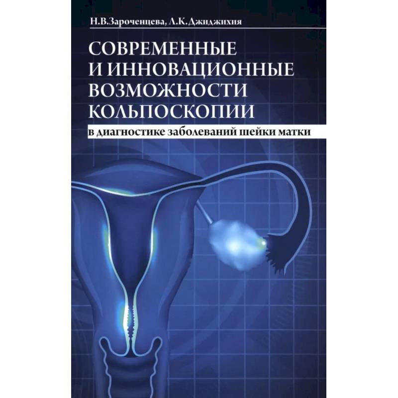 Современные и инновационные возможности кольпоскопии в диагностике заболеваний шейки матки.
