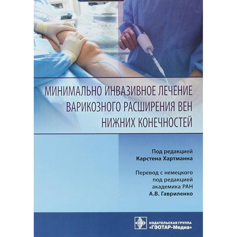 Минимально инвазивное лечение варикозного расширения вен