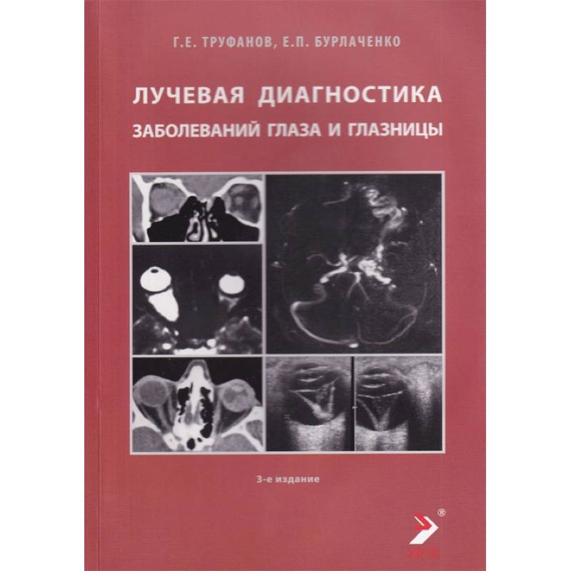 Лучевая диагностика заболеваний глаза и глазницы