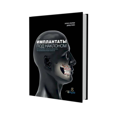 Стоматология, книга Имплантаты под наклоном. Протезирование с опорой на имплантаты при выраженной атрофии челюстей купить по скидке