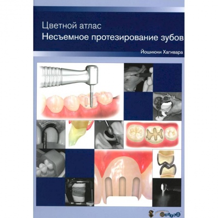 Стоматология, книга Несъемное протезирование зубов. Цветной атлас купить по скидке