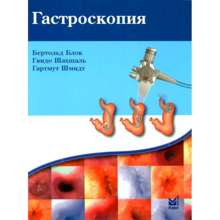 Гастроэнтерология, книга Гастроскопия купить по скидке