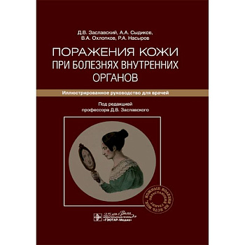 Поражения кожи при болезнях внутренних органов. Иллюстрированное руководство для врачей