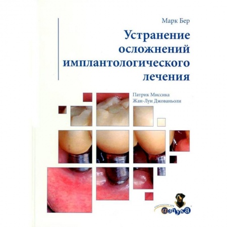 Стоматология, книга Устранение осложнений имплантологического лечения купить по скидке