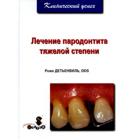 Стоматология, книга Лечение пародонтита тяжелой степени купить по скидке