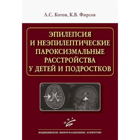 Другие виды специальной медицины, книга Эпилепсия и неэпилептические пароксизмальные расстройства у детей и подростков купить по скидке