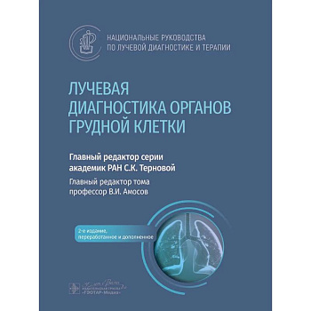 Лучевая диагностика органов грудной клетки: национальное руководство.