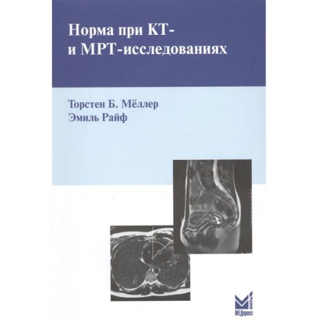 Фармакология. Рецептура. Токсикология, книга Норма при КТ- и МРТ-исследованиях. Мёллер Т.Б. купить по скидке