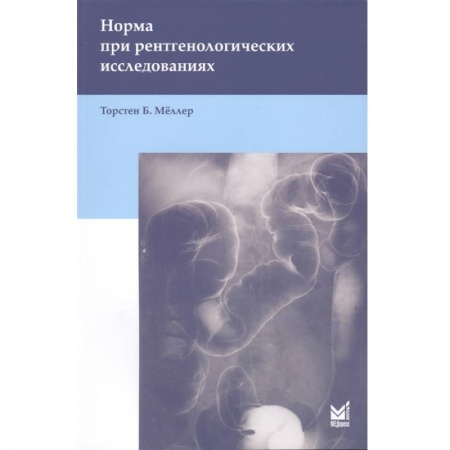 Фармакология. Рецептура. Токсикология, книга Норма при рентгенологических исследованиях . Мёллер Т.Б. купить по скидке