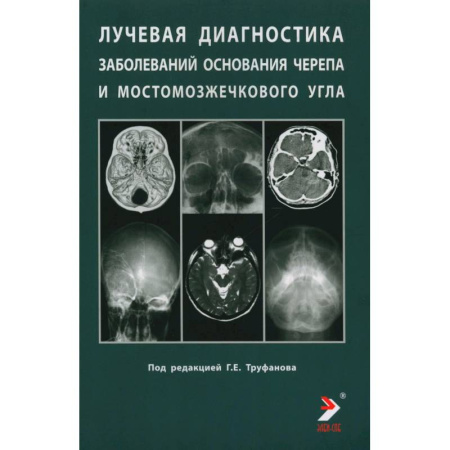 Неврология, книга Лучевая диагностика заболеваний оснований черепа и мостмозжечкового угла купить по скидке