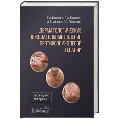 Другие терапии, книга Дерматологические явления противоопухолевой терапии купить по скидке