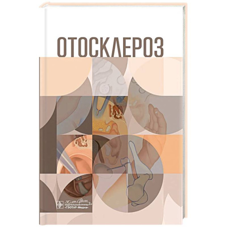 Патологическая анатомия и физиология. Иммунопатология, книга Отосклероз купить по скидке