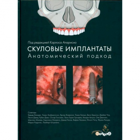 Стоматология, книга Скуловые имплантаты. Анатомический подход купить по скидке